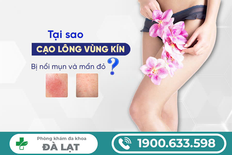 Cạo lông vùng kín bị nổi mụn: Nguyên nhân, hướng xử trí và cách phòng ngừa